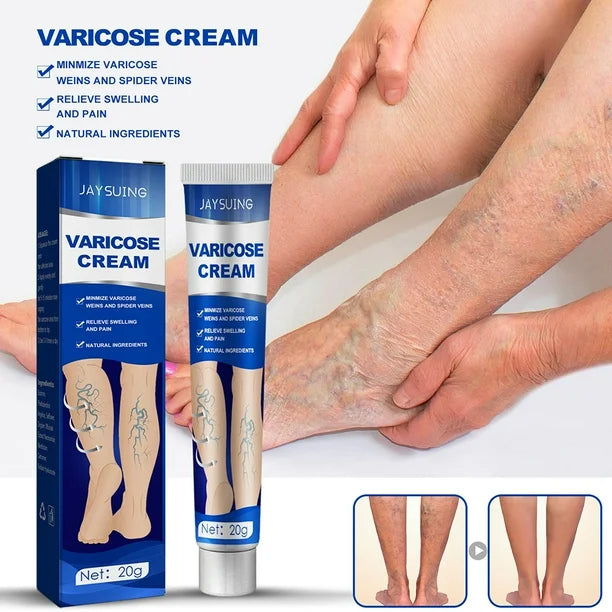 CREMA PARA VENAS VARICOSAS │ MD 12384